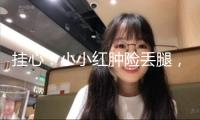 掛心！小小紅腫險(xiǎn)丟腿，紅會醫(yī)院“保肢天團(tuán)” 力挽狂瀾
