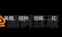 鼻痛、眼腫、側(cè)癱……知道陰險(xiǎn)埋伏的“毛霉菌病”！